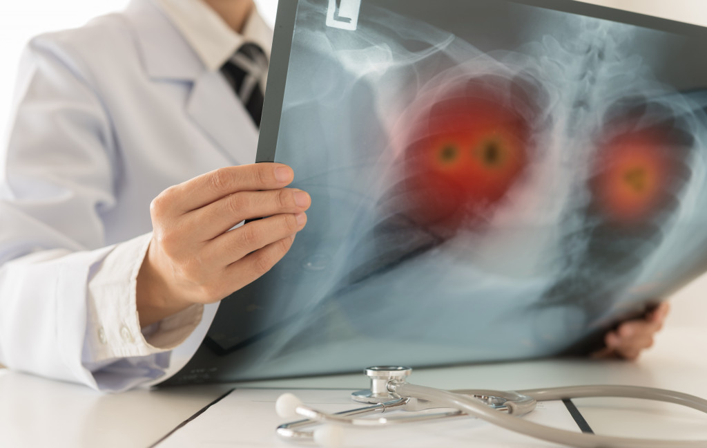 looking at xray